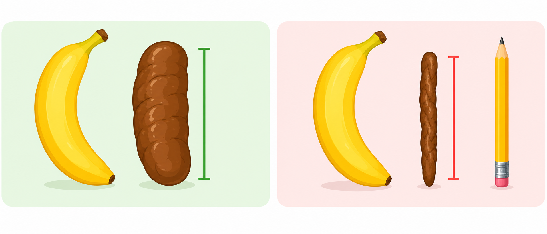Stool Caliber Comparison on Banana Scale: Normal Caliber vs Pencil Thin